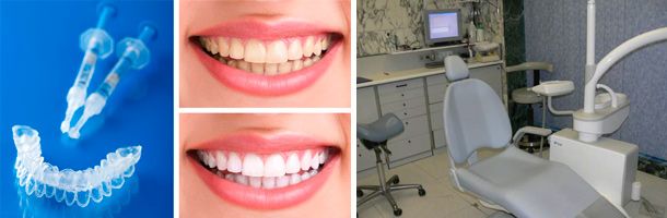 Clínica Dental Txurdinaga estética dental